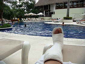 Mit Gipsbein am Pool